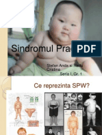 Sindromul Prader Willi