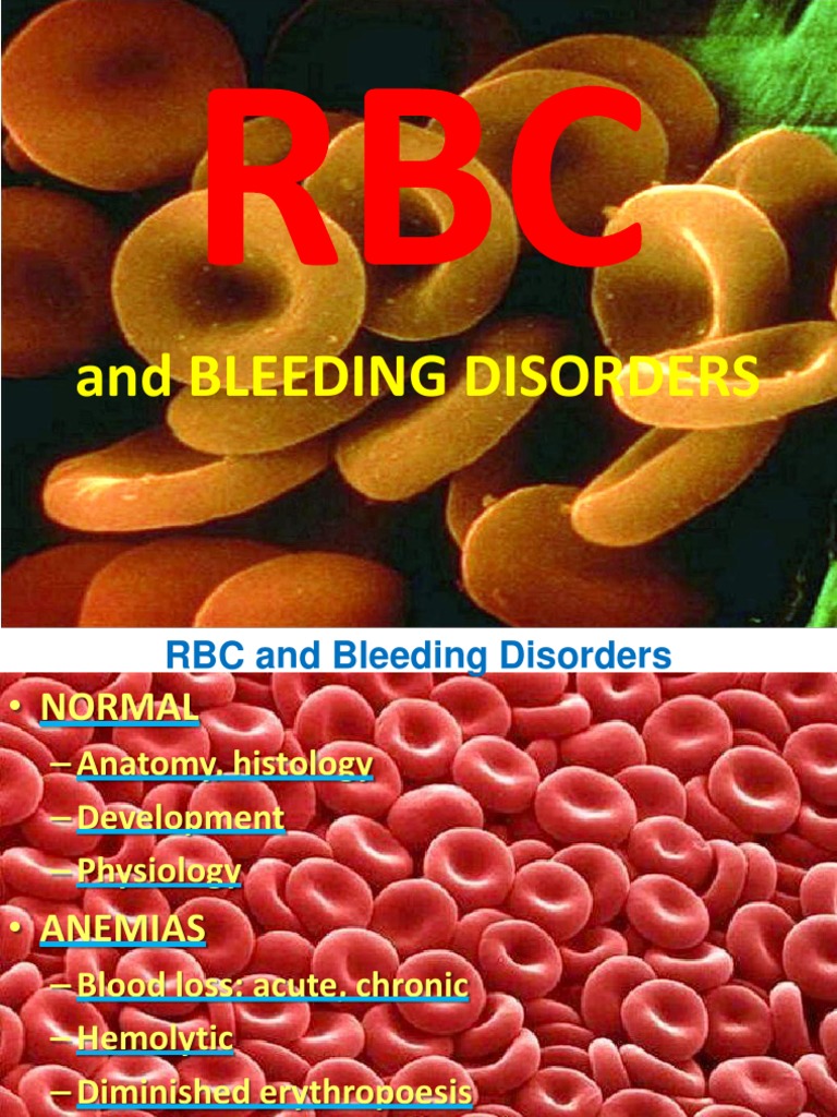 And Bleeding Disorders | PDF | Anemia | Haemophilia