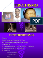 Hipotiroidismo Agosto 2013