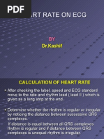 Download Heart Rate on Ecg by rera_avis SN16067135 doc pdf