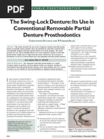 Download The Swing-Lock Denture_Its Use in Conventional Removable Partial Denture Prosthodontics by Elena Besliu SN160685949 doc pdf