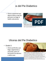 Ulceras Del Pie Diabetico