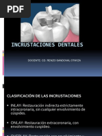 Incrustacion Overlay | PDF | Compuesto Dental | Materiales