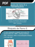 Bloqueio de Ramo E e Hemibloqueios