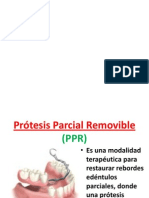 Protesis Parcial Removible