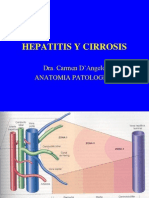 Hepatitis Cirrosis