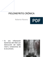 Pielonefritis Crónica