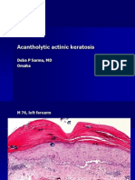 Acantholytic Actinic Keratosis, M 76, Left Forearm