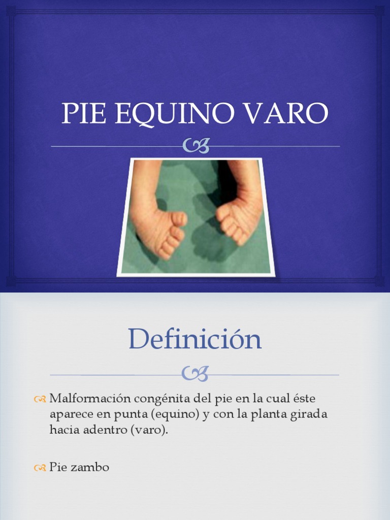 Pie Equino Varo PDF Pie Anatomía humana