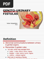 Genito-Urinary Fistulas: Yashar Najiaghdam M.D