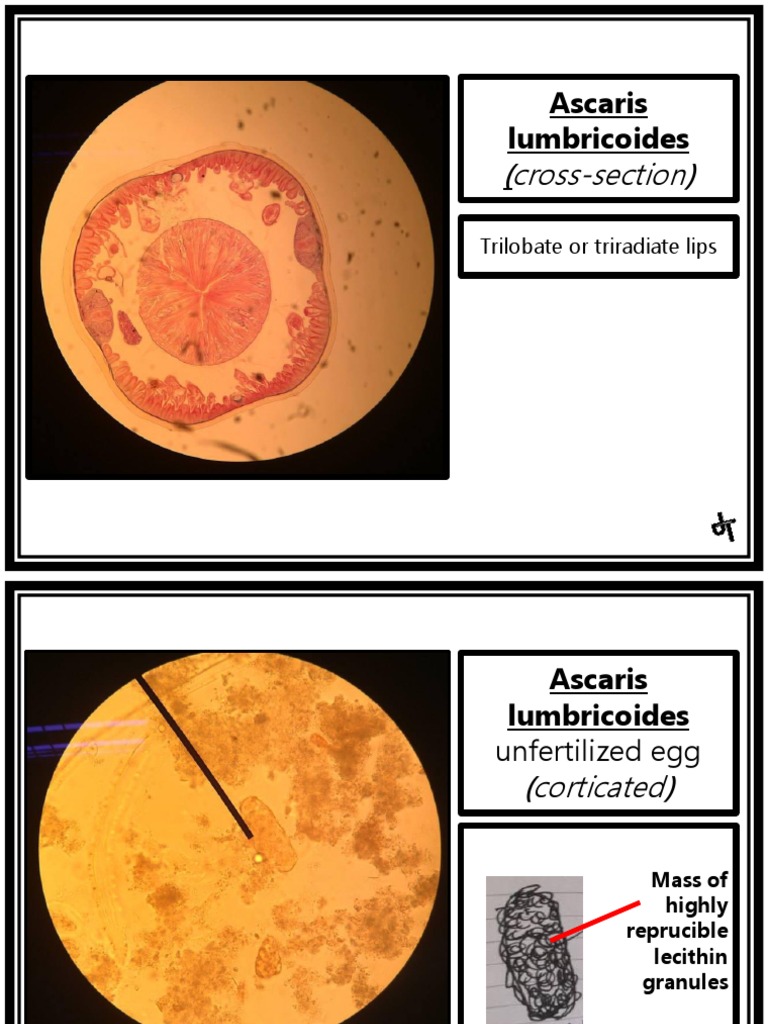 Parasitology (Laboratory) NEMATODES Ascaris Lumbricoides