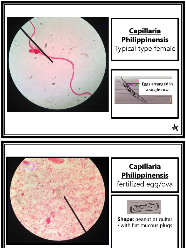 Parasitology (Laboratory) NEMATODES Capillaria Philippinensis