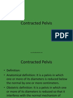 Contractedpelvis 100515015729 Phpapp01