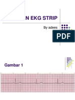 Latihan Ekg Strip