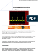 Eletrocardiograma - Monitoramento dos batimentos cardíacos - Saber Eletrônica Online