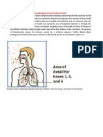 Tuberkulosis Perinatal Bermanifestasi sebagai Tuberkulosis Milier dan Meningitis