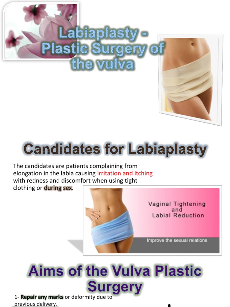 Labiaplasty for Labia Deformities | PDF