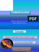 Tuberculosis