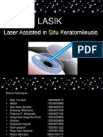 Lasik