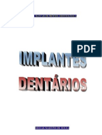 Implantes Dentários (Manual) PDF