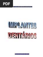 Implantes Dentários (Manual).pdf