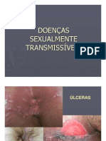 doenças sexualmente transmissiveis