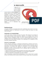 Infarctus Du Myocarde