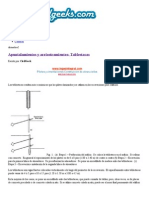 Apuntalamientos y Arriostramientos - Tablestacas - CivilGeeks