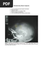 Download Biotelemetry Brain Implants by Scribdocuments SN16390476 doc pdf