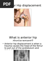 Download Anterior Hip Displacement Presentation by fatsabawi SN16441663 doc pdf