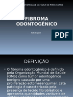 Fibroma Odontogênico