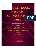 Frequency of Carcinoma in Non-Toxic Multi Nodular Goitres (MNGS)