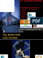 Coccydynia (Tail Bone Pain)