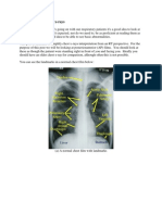 Tips For Reading Chest X