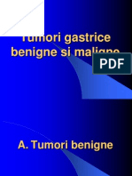 Tumori Gastrice Benigne Si Maligne2010