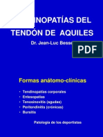 tendinitis Aquiles.ppt