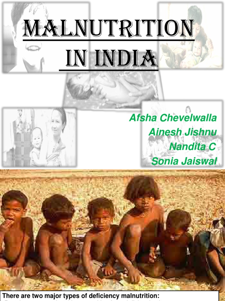 Malnutrition in India.2 | PDF | Malnutrition | Nutrition