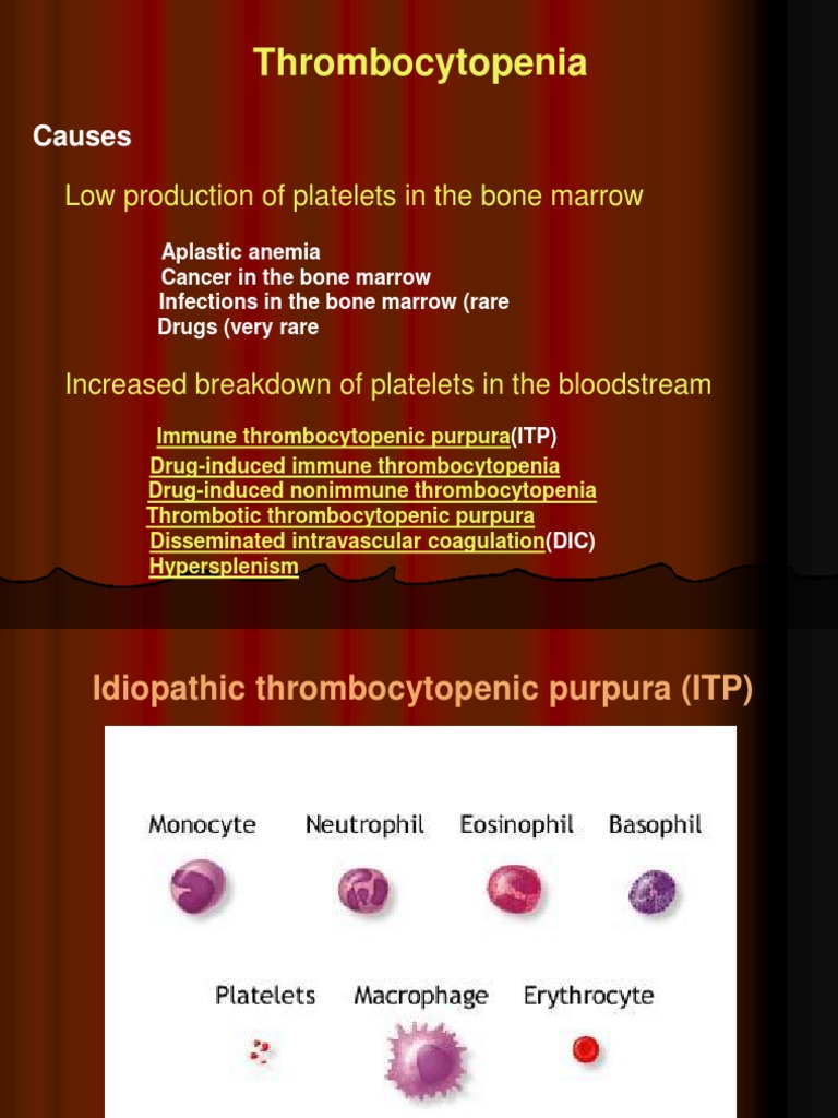 Idiopathic Thrombocytopenic Purpura