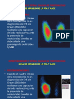 Hipertiroidismo y Otras Causas de Tirotoxicosis (E)