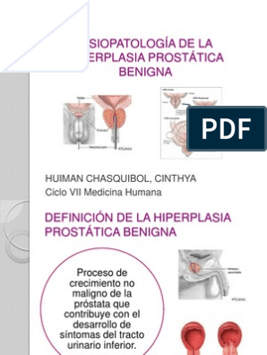 hiperplasia prostática benigna: fisiopatología pdf