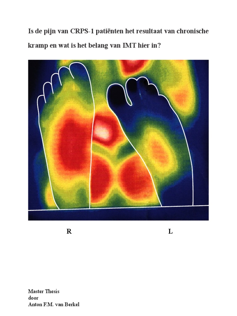 Is De Pijn Van Crps 1 Patienten Het Resultaat Van Chronische Kramp Thesis Final Nl