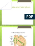 Bradycardias and Heart Blocks