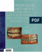 Treatment of Class II Malocclusion