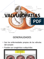 VALVULOPATÍAS