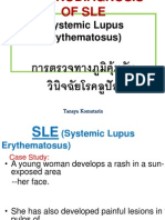Laboratory Diagnosis and Anti-Sm Antibodies in SLE