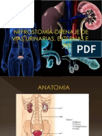 Catéter Doble J y Nefrostomía Percutánea