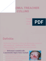 Sindromul Treacher Collins