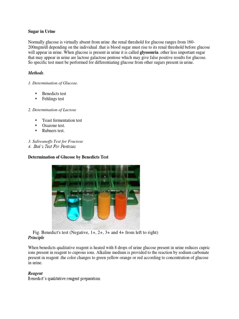 Sugar in Urine Urine