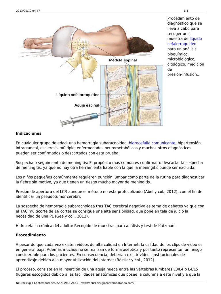 Puncion Lumbar | PDF | Procedimientos médicos | Especialidades Medicas