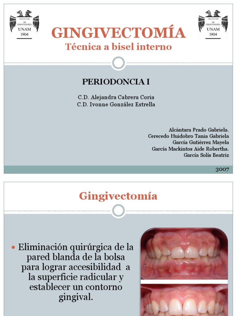 Gingivectomía: Técnica a Bisel Interno | PDF | Boca | Especialidades ...